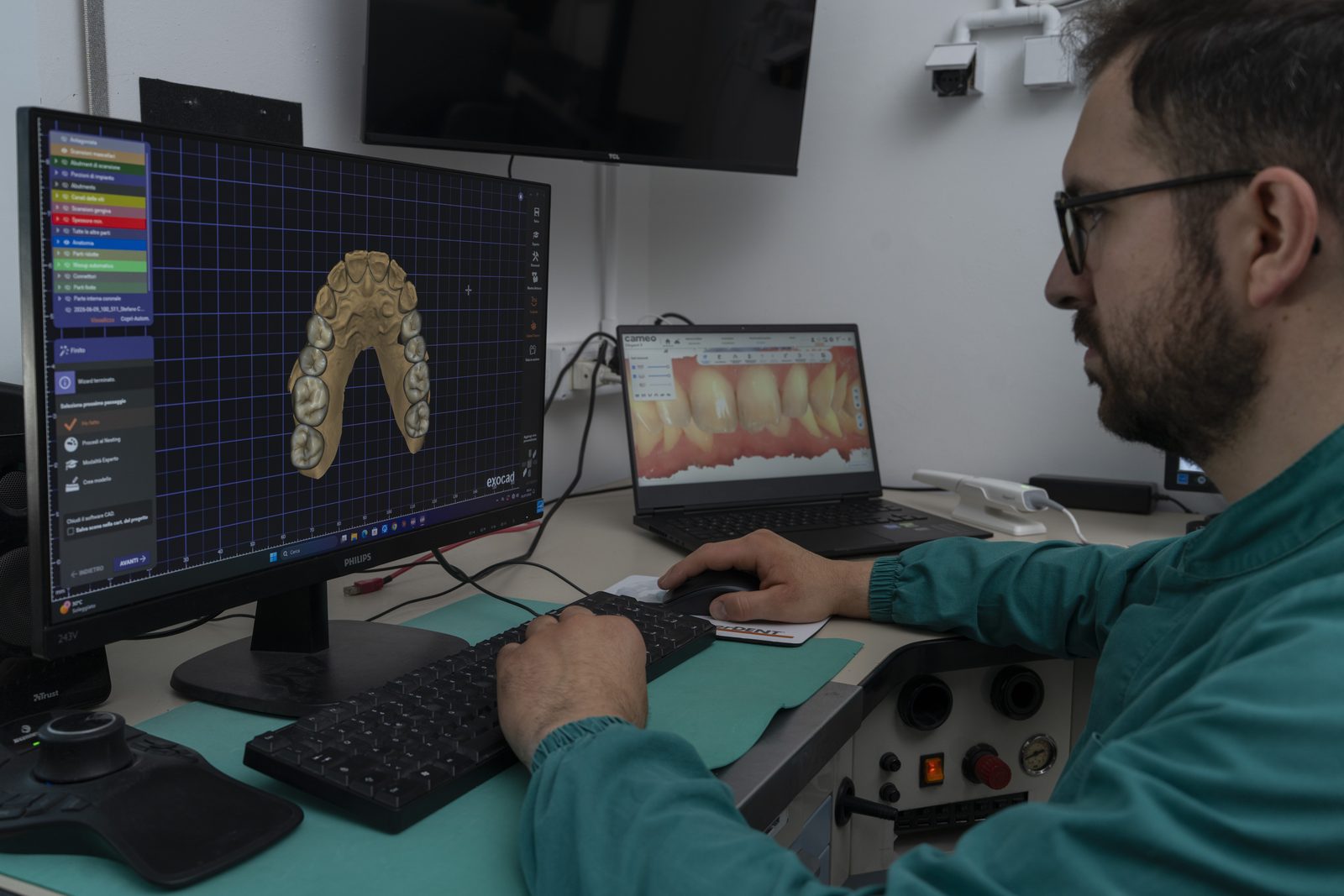 Progettazione CAD del manufatto
